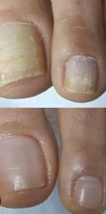 55 Lei Ofer sercivii de cosmetizare calcaie si pedichiura cosmetica  la domiciliul clientei - Bucuresti