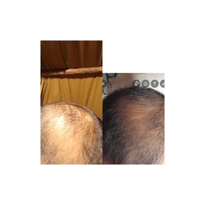 Продам шампунь из южной кореи