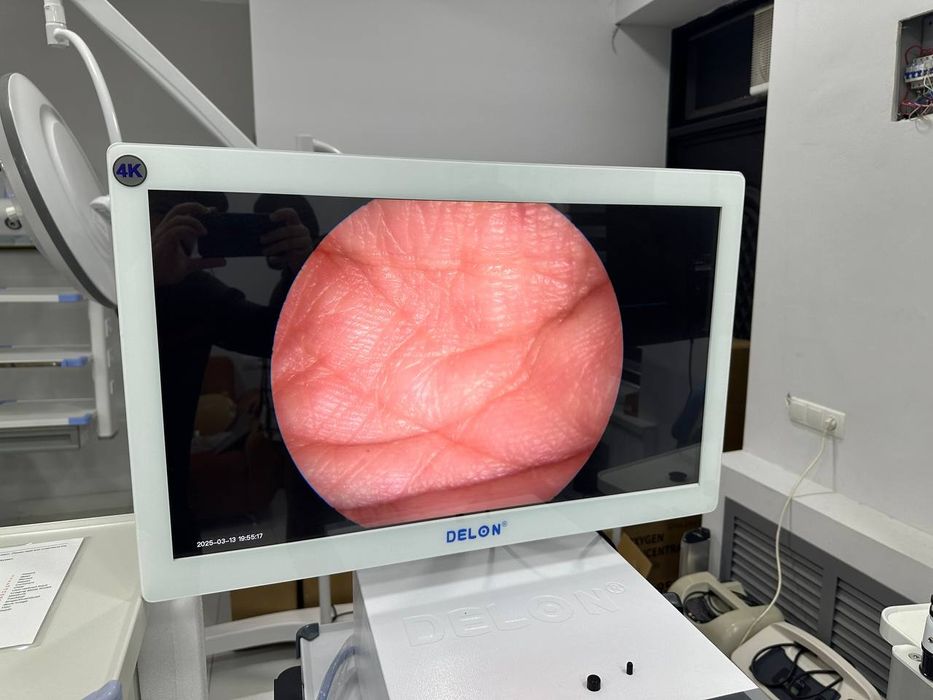 Видеоэндоскопы (видеоэндоскопические системы) от бренда Aokace