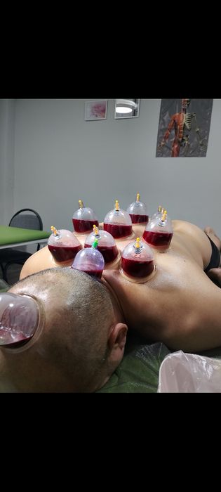 Хиджама профессиональный