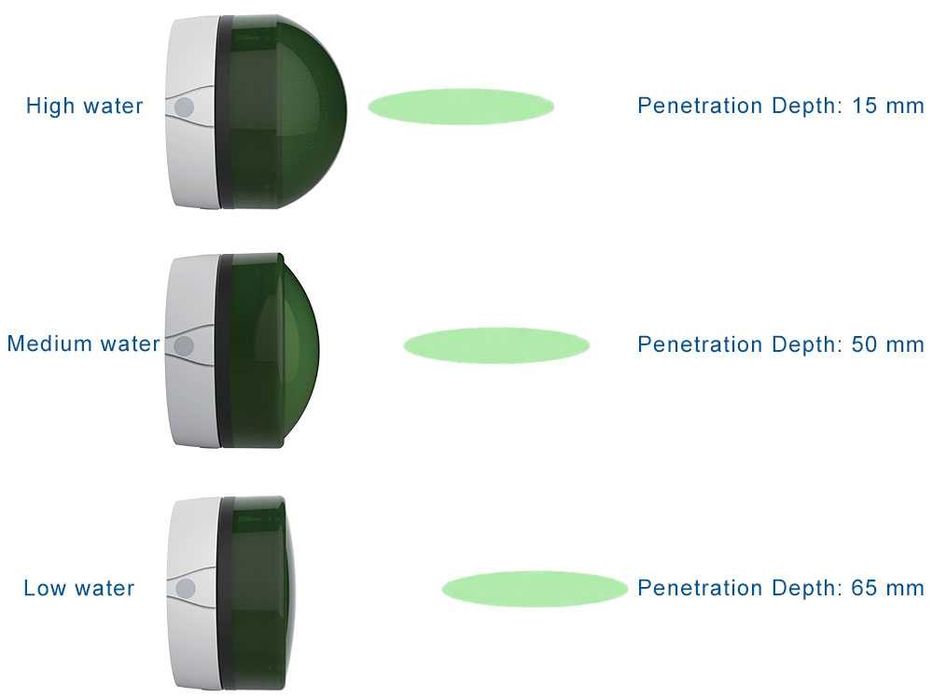 Фокусиран шокуейв AresPro EMFOCUS