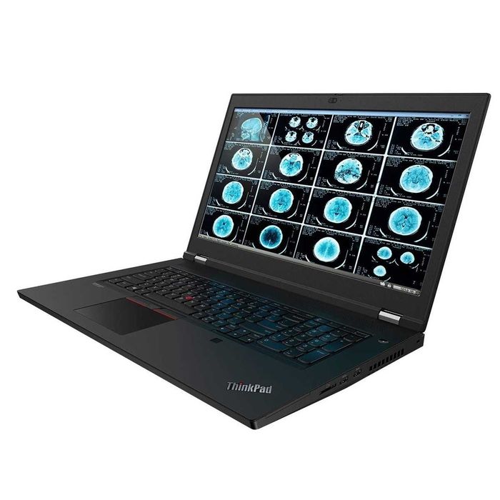 Laptop Workstation Refurbished – Lenovo ThinkPad P17 Gen 1 – Intel Core i7-10875H – 32-64GB DDR4 – 1TB SSD NVMe – NVIDIA RTX 3000 6GB – 17.3  FHD IPS