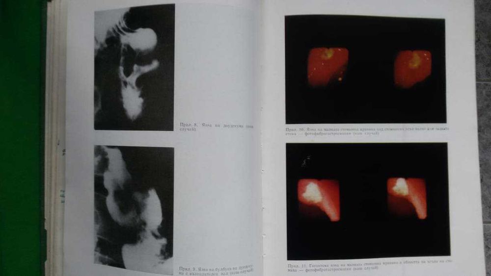 Ръководство по вътрешни болести  II том –акад.Ташев, проф.Пенчев и др.