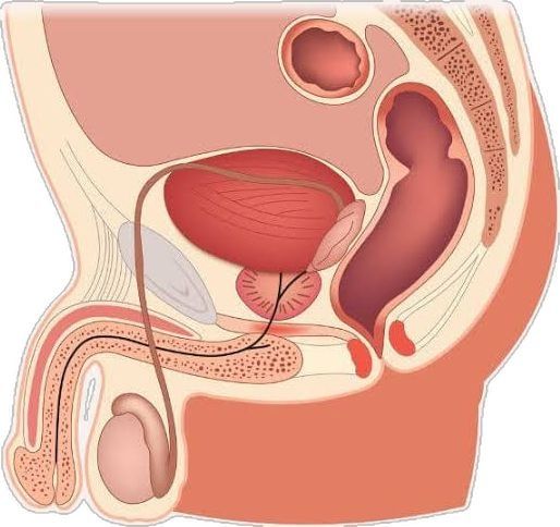 Массаж простаты Адэма