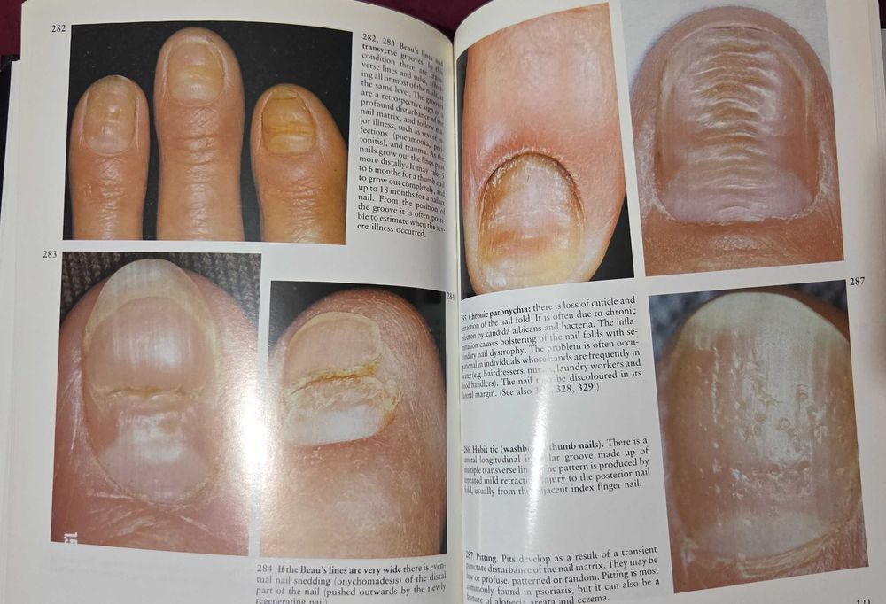 A Colour Atlas of the Hair, Scalp and Nails