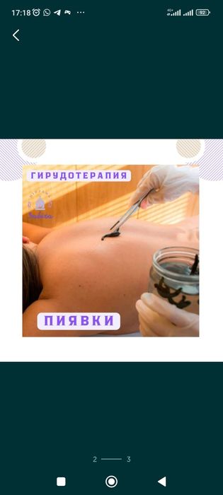 Пиявки.  Сүлік.    Гирудотерапия