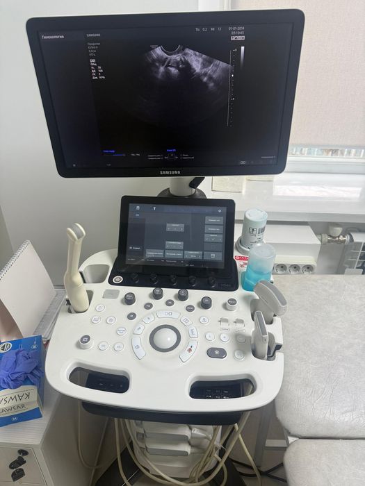 УЗИ Samsung Madison HS 40