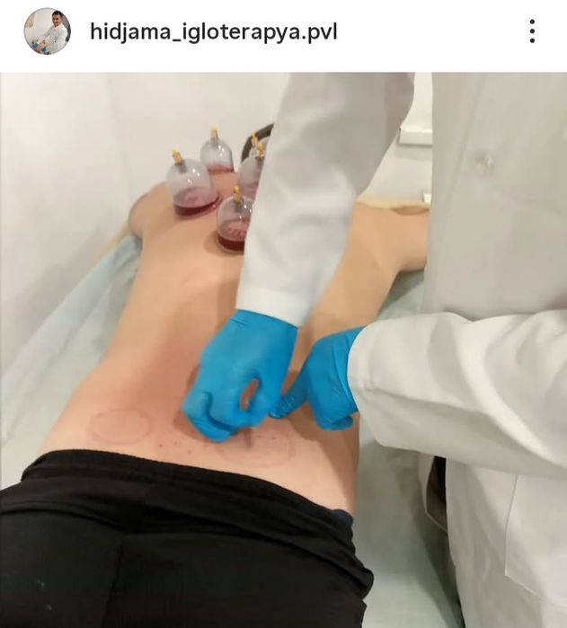 Хиджама  в Павлодаре