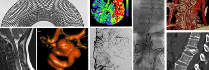 ВТОРО МНЕНИЕ ЗА КОМПЮТЪРНА ТОМОГРАФИЯ РЕНТГЕН СКЕНЕР ЯДРЕНО-МАГНИТЕН РЕЗОНАНС МАМОГРАФ.Разчитане на Образни Изследвания-КТ CT ЯМР MR Рентгенова снимка