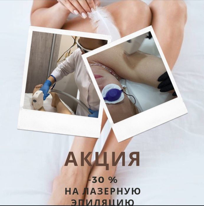 Лазерная эпиляция