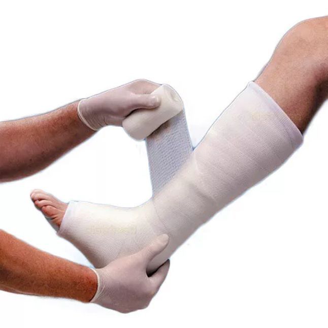 Наложение легкого полимерного гипса