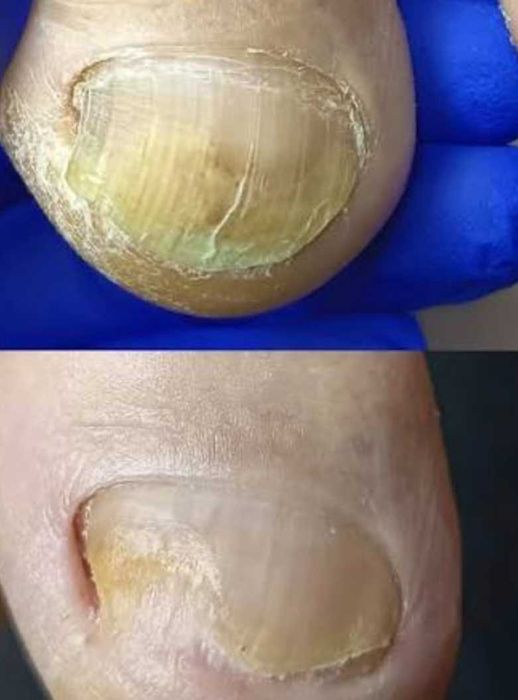55 Lei Ofer sercivii de cosmetizare calcaie si pedichiura cosmetica  la domiciliul clientei - Bucuresti