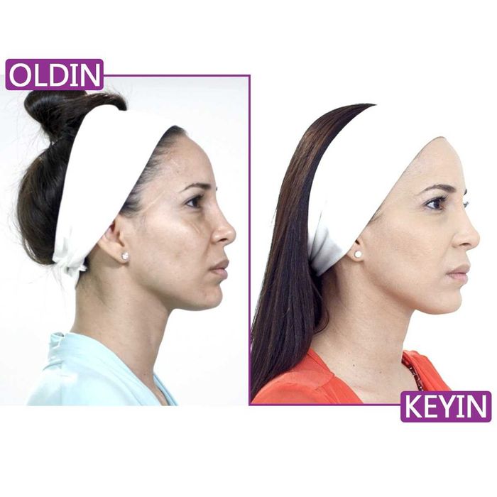 Ellezza — гель для лица с экстрактом улитки против морщин и пятен