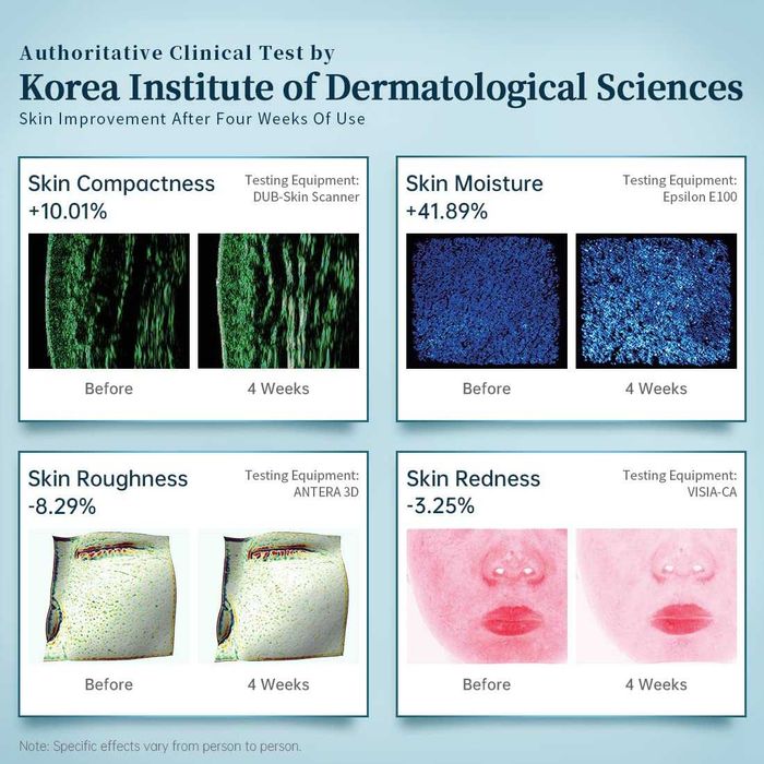 LED маска за лице GYH Cloud-S