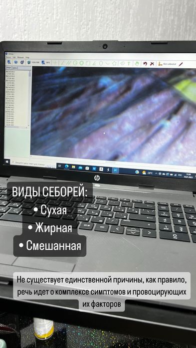 Лечение кожи головы/восстановление волос