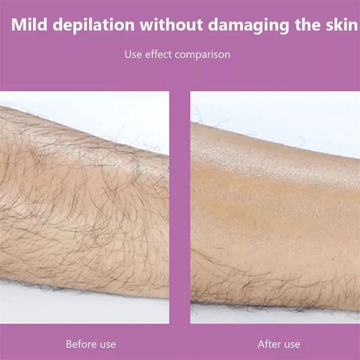 Кристален епилатор за премахване на космите чрез триене