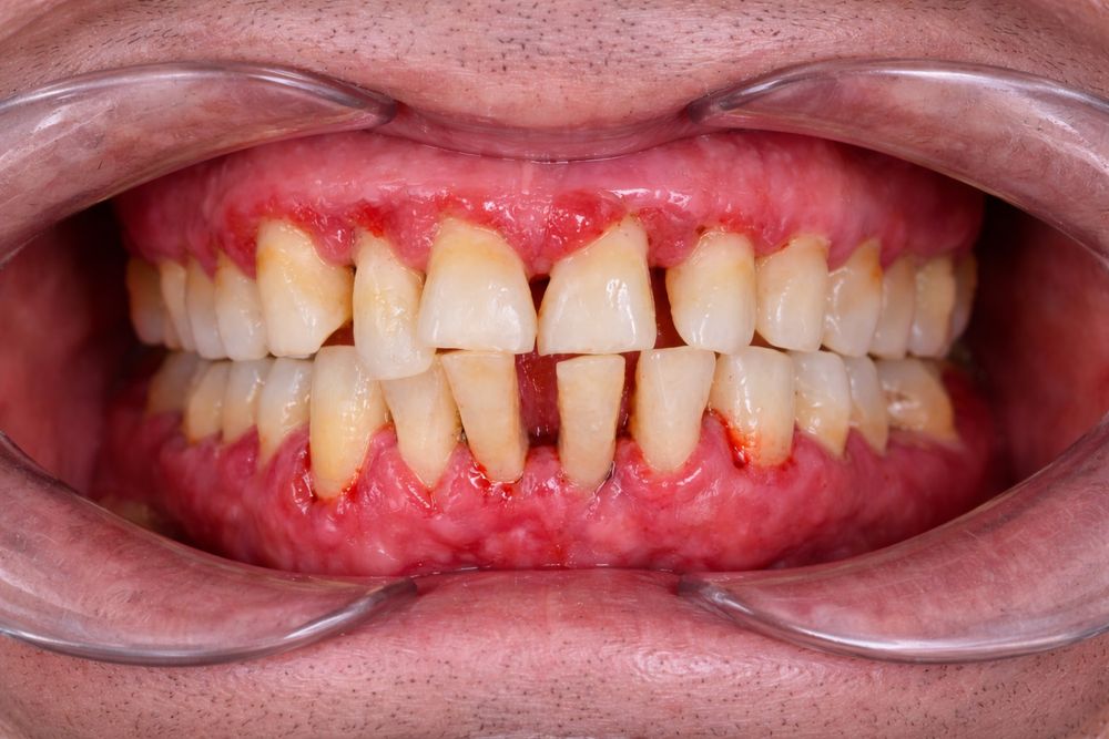 Consult gratuit facultatea de Medicina Dentara