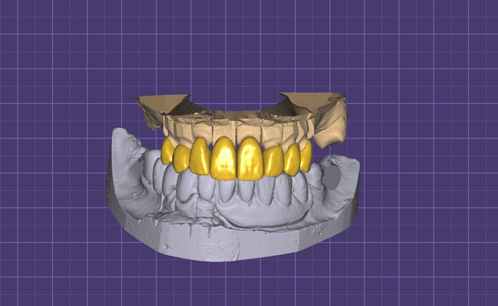 Практика для зубных техников