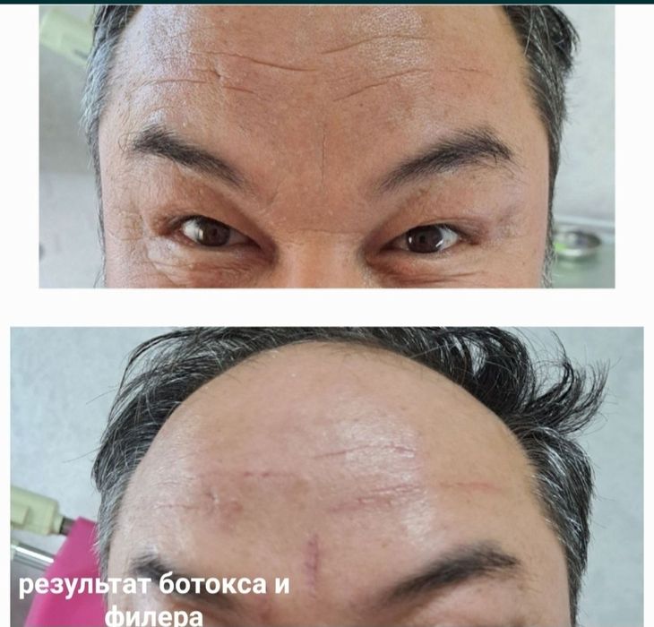 Депиляция г. АЛМАТЫ