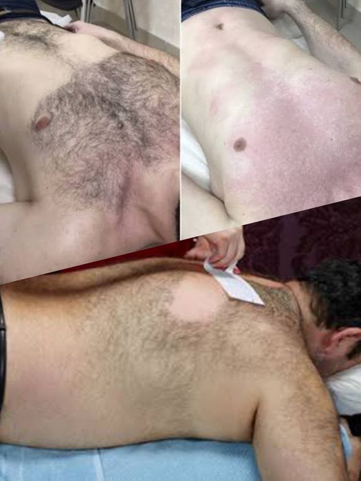 Депиляция для мужчин и женщин