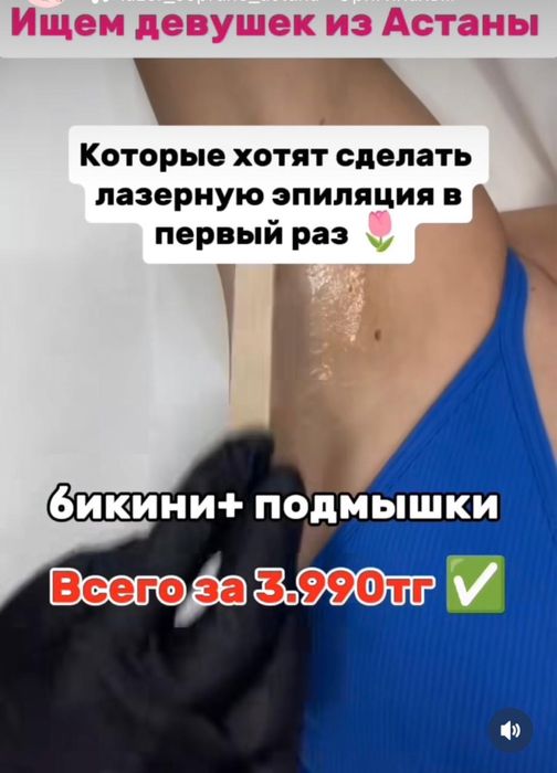 Лезерная эпиляцыя по доступным ценам, на аппарате Soprano Titanium.