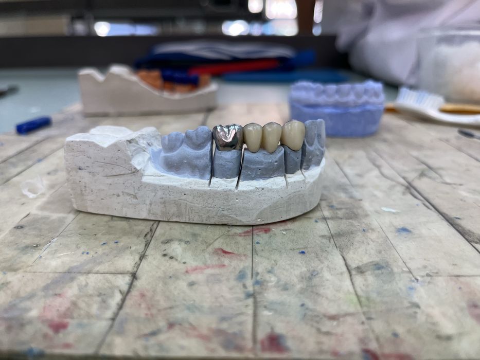 Зъболекарски услуги