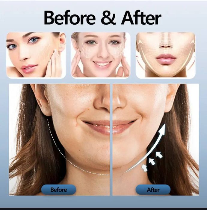 Косметологическое устройство  Формирователь лица.