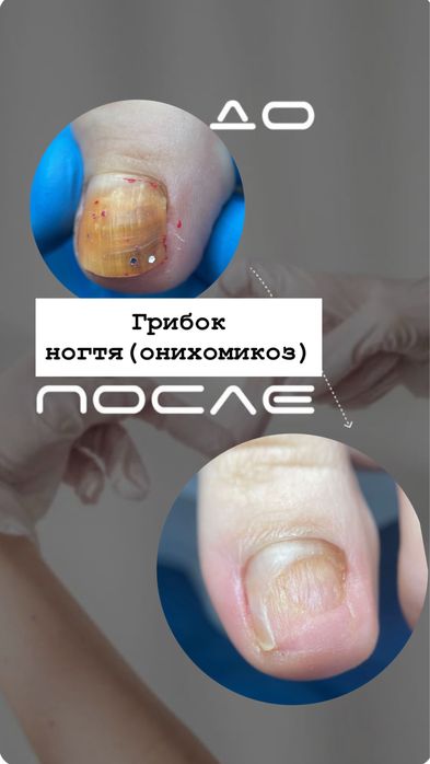 Мастер педикюра-подолог