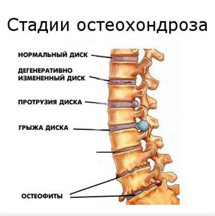 Хиджама. Мануальная терапия профессионально