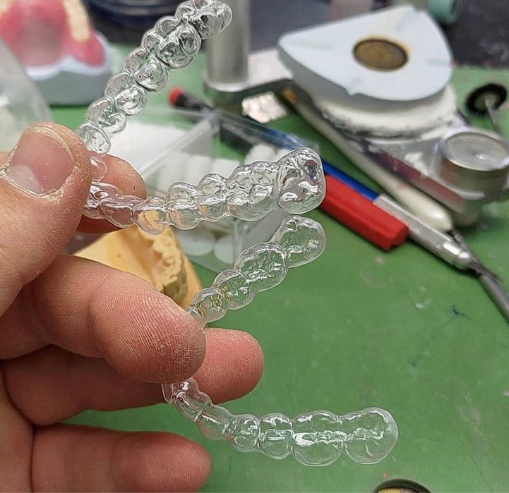 Зубной каппа после брекет