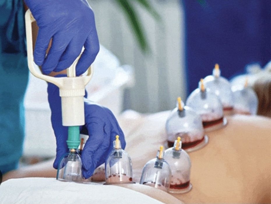 Hijama qilamiz (uyga borib)
