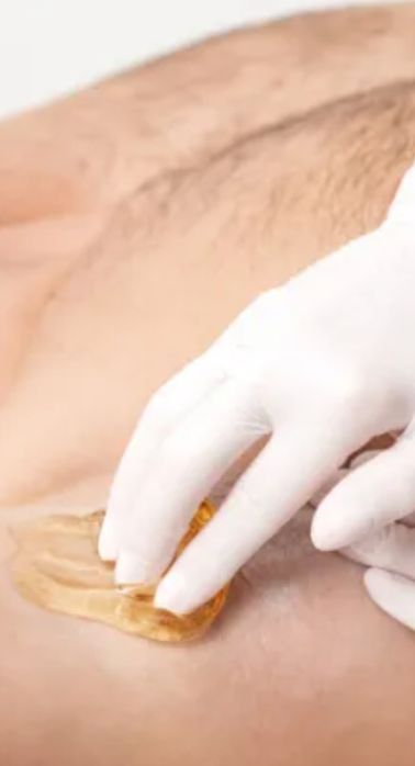 Шугаринг сахарной пастой