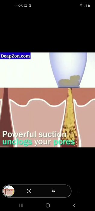 Вакум апарат 4та насадкали. Оригинал 100% тортиш кучи супер.