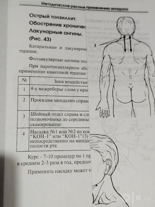 Медицина аппарати