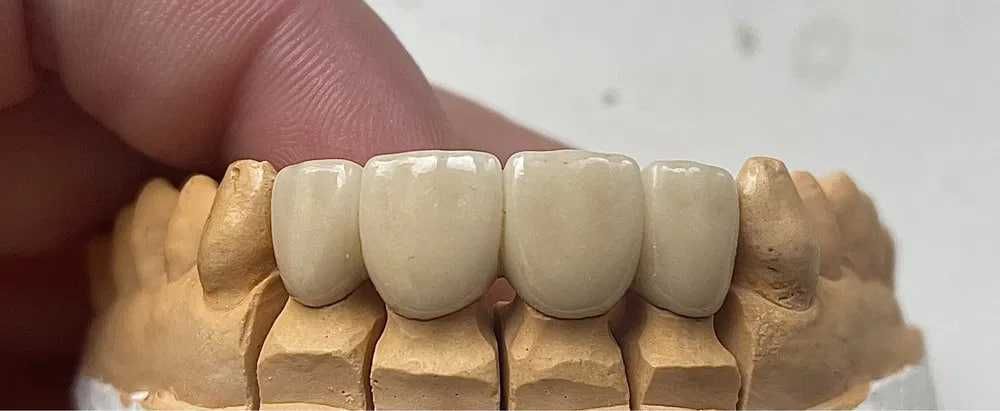 CAD/CAM технология зубного техника