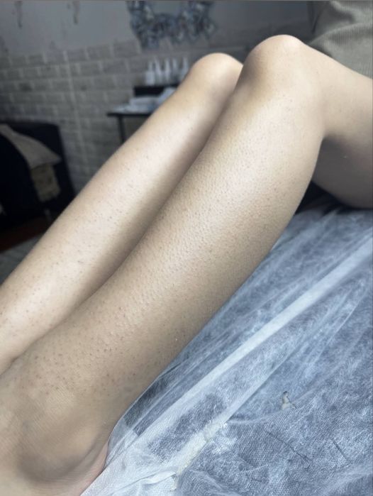 Шугаринг/депиляция/Чирчик только женщины!