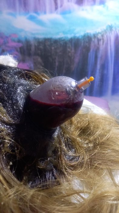 Аль Хиджама Лечебная