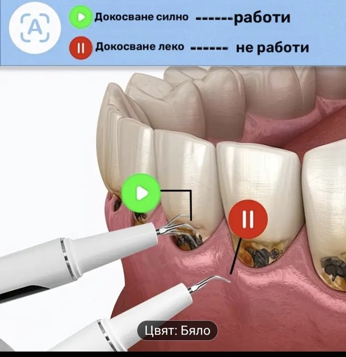 Машинка за чистене на зъбен камък