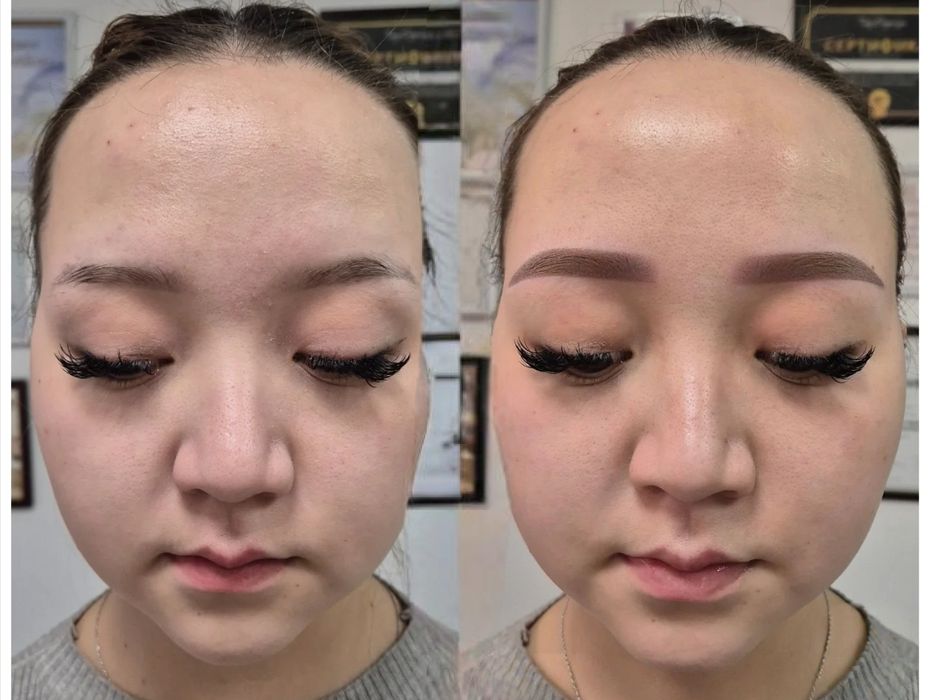 Действует только для женщин.