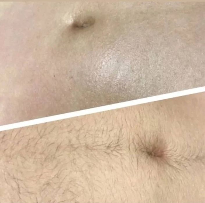 Depilyatsa hizmati uyingizda