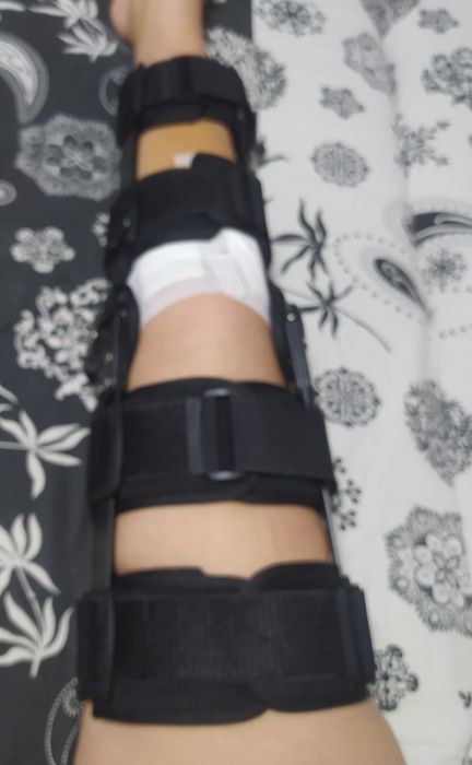 Шарнирный ортез для колена