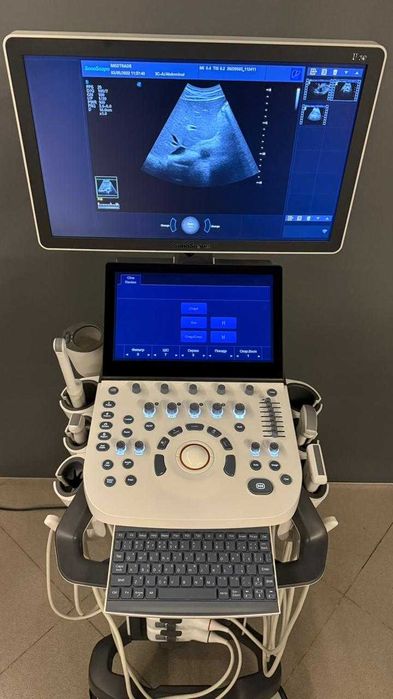 Продам узи аппарат SonoScape P20 с 4 датчиками в отл состоянии