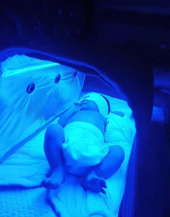 Fotolampa. Fototerapiya. Фотолампа. Фототерапия. Аренда. Ijara