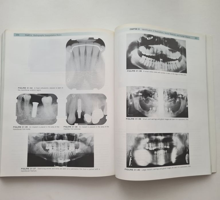 Dental radiography