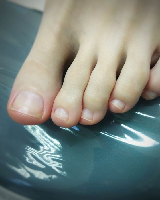 Педикюр, подолог