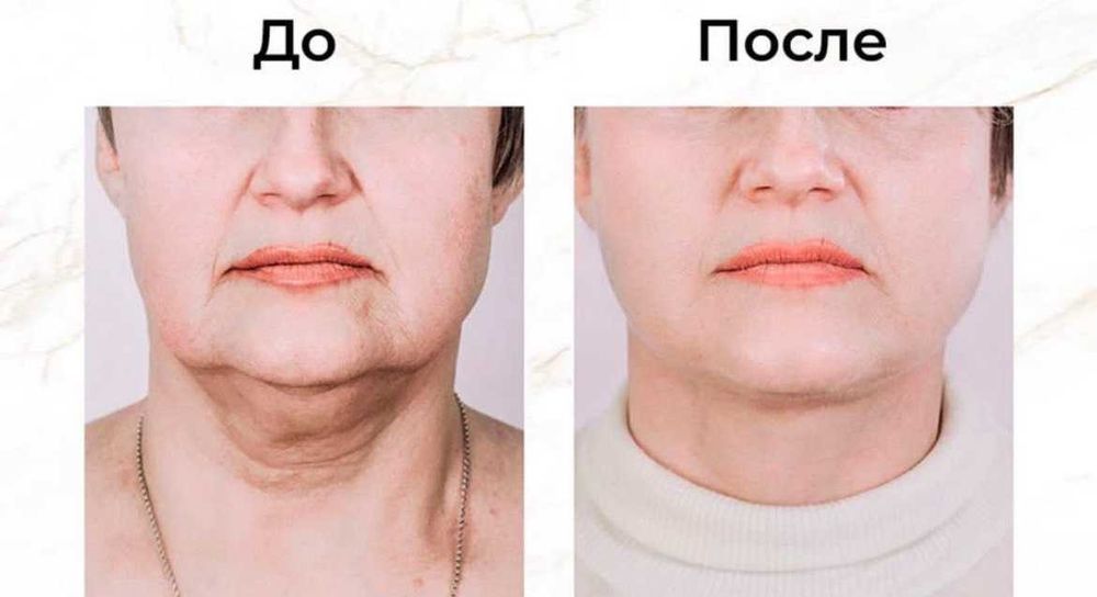 Kosmetolog | Yuzni tozalash, parvarish, pilinglar | OLMAZOR