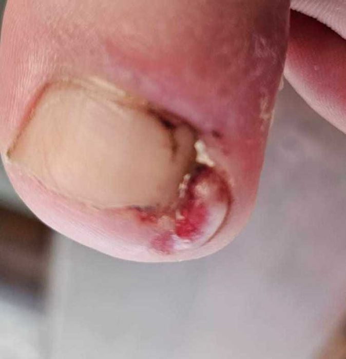 Podologica Pedichiura complexa