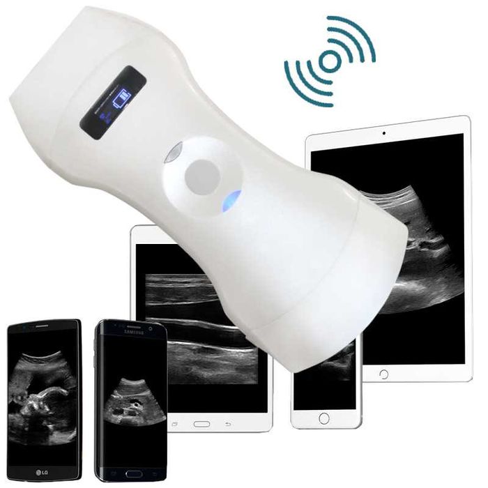 УЗИ аппараты и допплеры