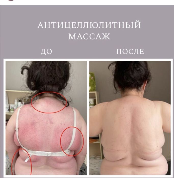 Все вида массажа