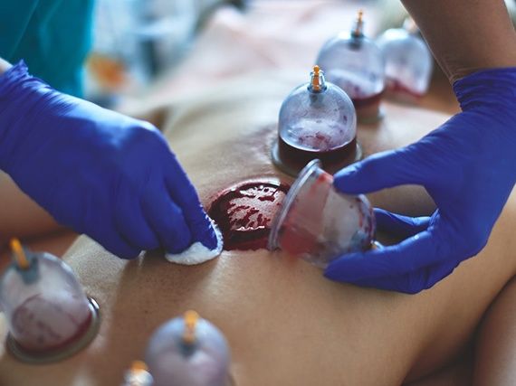 Хиджама в Каскелене